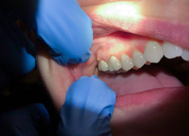 Best Emergency Treatment for Toothache in Nashua, NH