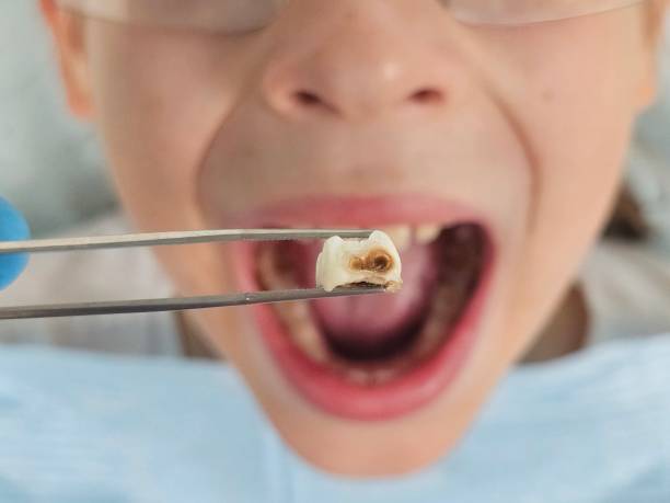 Best Pediatric Emergency Dentist in Nashua, NH
